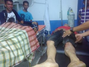 Dua Orang Warga Koltim Tewas, Akibat Kecelakaan Lalu Lintas