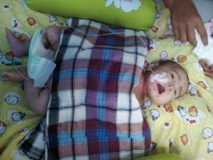 Alami Gizi Buruk, Kulit Balita ini Melepuh