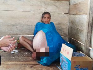 Tujuh Tahun Digerogoti Tumor Ganas, Wanita Asal Buton Utara ini Butuh Uluran Tangan