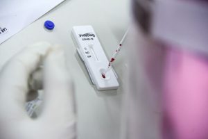 Rapid Tes, Satu Warga Banubanua Jaya Reaktif, Begini Penjelasan Jubir GTC-19 Butur